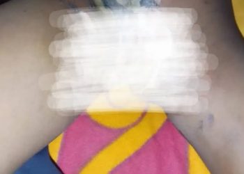 Bauchi Woman Arrested For Burning 7-Year-Old Sister-In-Law’s Private Parts With Hot Metal Over Witchcraft Accusation