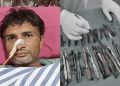 Doctors Shocked After Finding 50 Objects Inside Man’s Stomach During Surgery